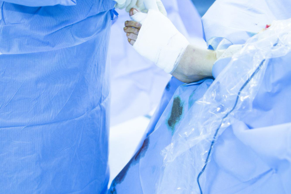 Amputaciones de pie diabético en Cancún, Q.R.: Manejo quirúrgico especializado para prevenir complicaciones