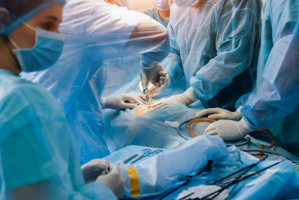 Apendicectomía laparoscópica y abierta