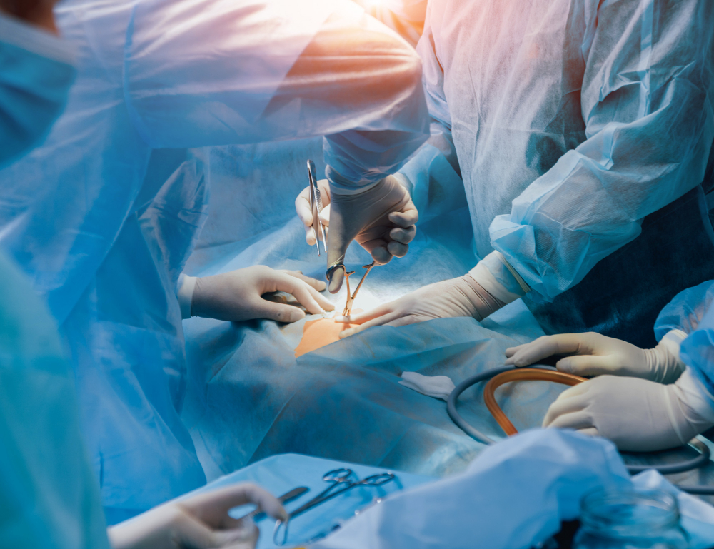 Colocación de catéter Tenckhoff o de diálisis peritoneal en Cancún, Q.R.: Acceso seguro para el tratamiento renal