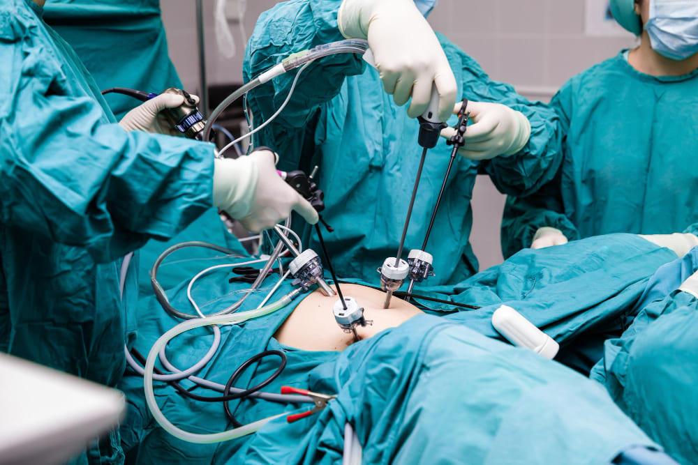 Laparotomía o laparoscopia diagnóstica